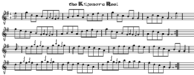 Kilfenora Reel